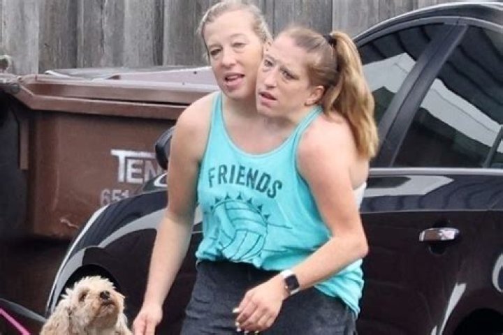 Abby and Brittany Hensel Baby: A Fascinating Look into Their Lives and Parenthood Journey