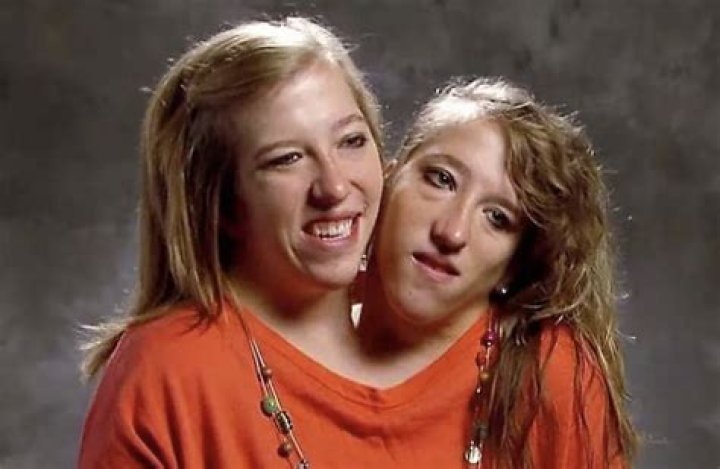Heartfelt Reflections on Abby and Brittany Hensel: The Sad News That Shook Us