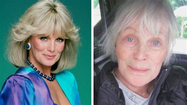 Linda Evans Today: The Timeless Beauty and Enduring Legacy