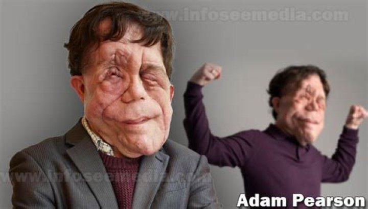 Discovering Adam Pearson's Height: The Man Behind the Screen