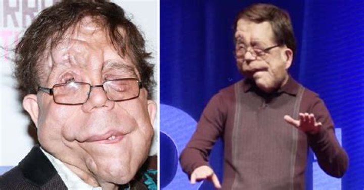 Exploring Adam Pearson's Relationships: A Journey of Love and Companionship