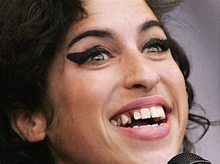The Truth About Amy Winehouse's Notorious Tooth Gap