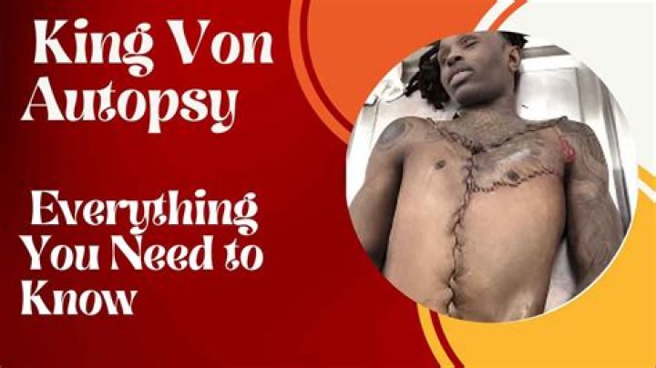 Unraveling the Mystery: The Autopsy of King Von