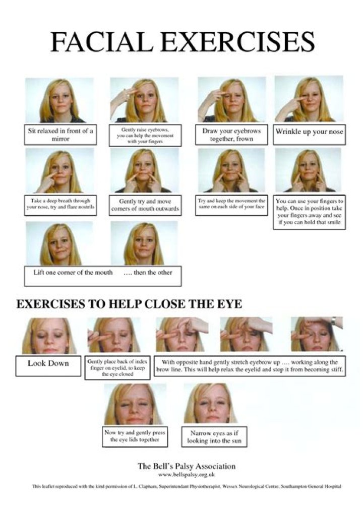 Bell's Palsy Facial Exercises: Your Comprehensive Guide to Recovery