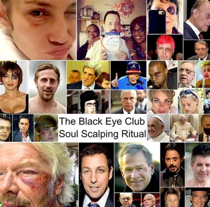 Join the Elite: Unlocking the Secrets of the Enigmatic Black Eye Club