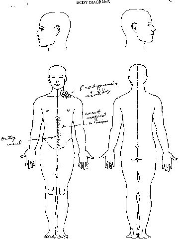Brandon Lee Death Body: A Detailed Exploration of the Tragic Incident