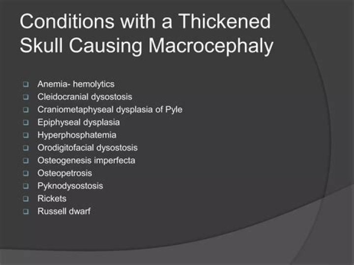 Understanding the Causes of Macrocephaly: A Comprehensive Guide