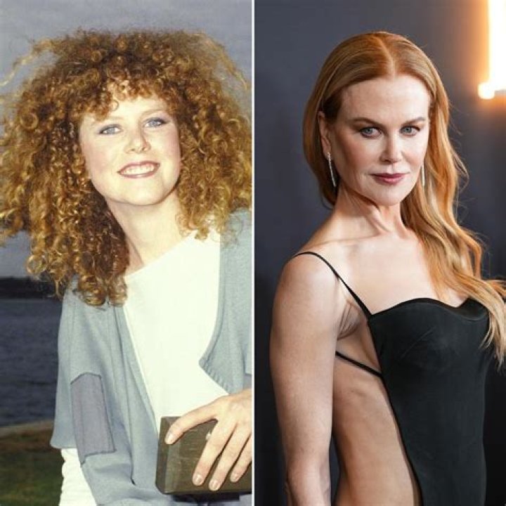 The Truth about Nicole Kidman's Nose: Plastic Surgery Revealed