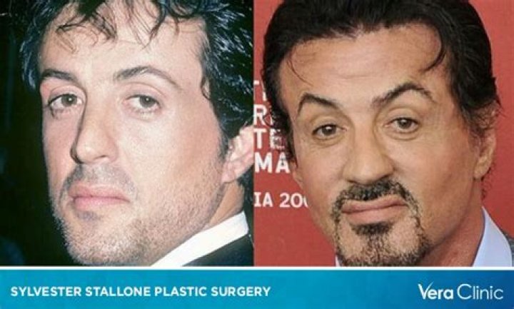 Did Sylvester Stallone Have a Stroke? Uncovering the Truth Behind the Rumors