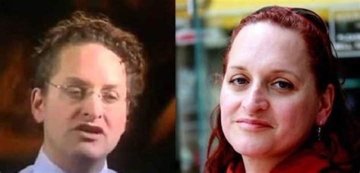 Understanding Dr. Lynette Nusbacher Before Surgery: A Journey of Transformation