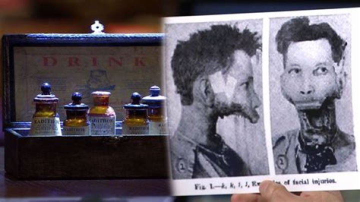 Eben Byers: The Tragic Tale of a Wealthy Socialite and Radium Poisoning