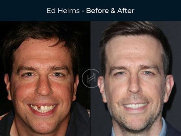 Exploring Ed Helms' Relationship Journey: Beyond the Laughter