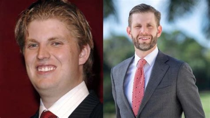 Unveiling the Truth Behind Eric Trump's Plastic Surgery Rumors