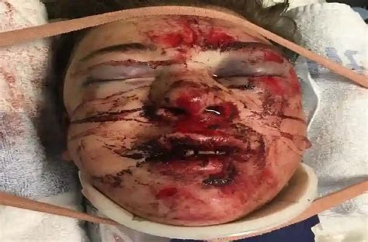 Face Split Diving, LiveGor3: Understanding the Phenomenon and Its Impact