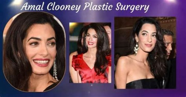 Has Amal Clooney Had Plastic Surgery? Unveiling the Truth