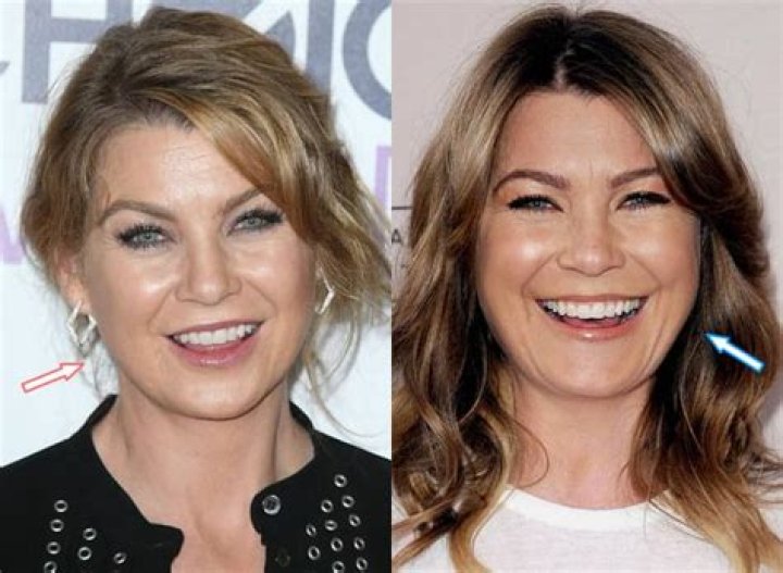 Has Ellen Pompeo Had Plastic Surgery? A Comprehensive Analysis
