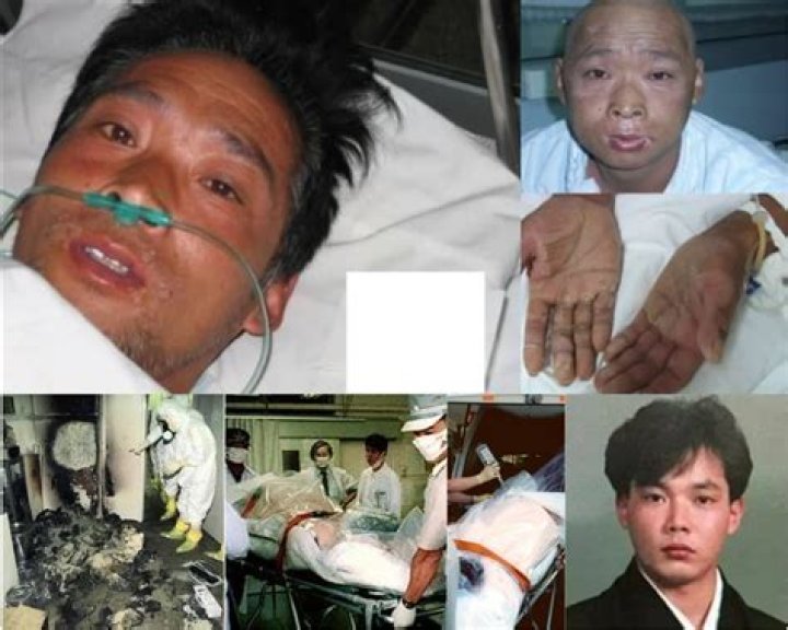 The Tragic Tale of Hisashi Ouchi: A Journey Through Radiation Exposure and Medical Intervention