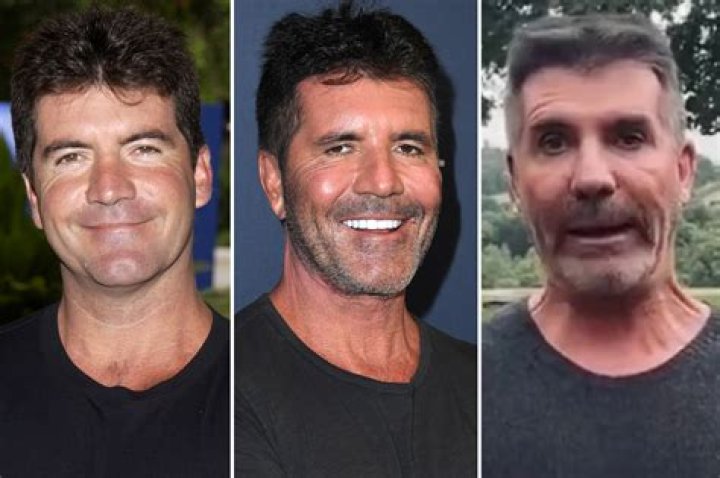 Unraveling the Truth: Is Simon Cowell's Son Disabled?
