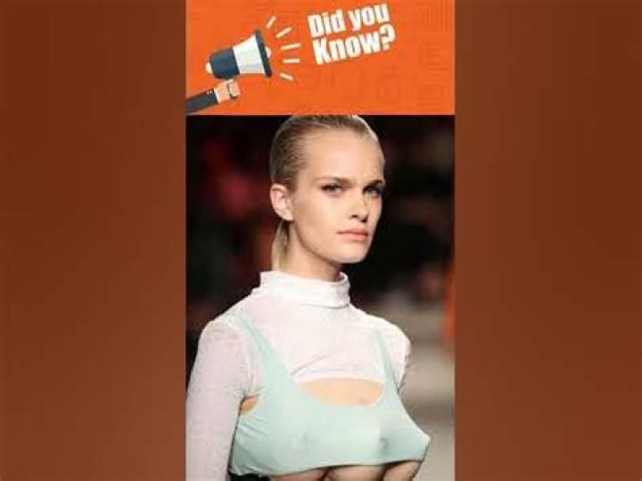 Is There a Woman With Three Breasts: Exploring the Rare Medical Condition