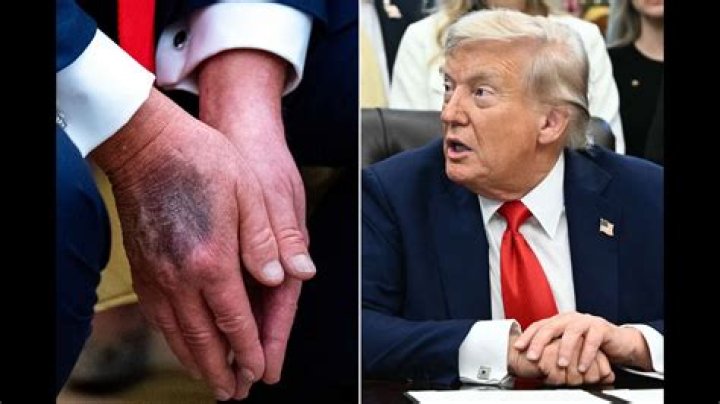 Is Donald Trump Still Living or Dead? The Definitive Answer