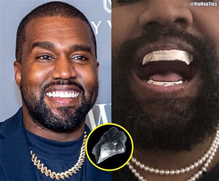Kanye's Iconic Smile: The Story Behind Kanye Teeth
