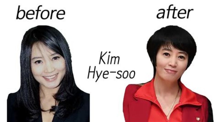 Kim Hye-Soo's Lip Surgery: Unveiling the Transformation
