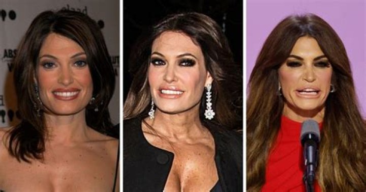 Unveiling the Transformation: Kimberly Guilfoyle and Her Plastic Surgery Journey
