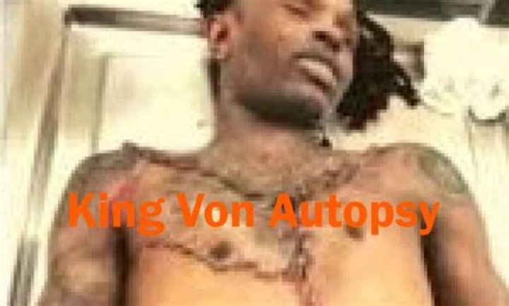 King Von Autopsy Released: Unveiling the Truth Behind His Tragic Death