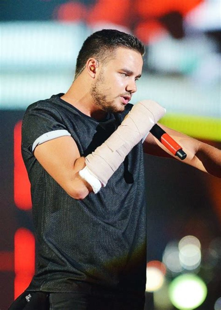 Liam Payne's Broken Arm: The Story Behind the Injury