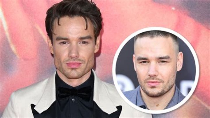 Liam Payne's Journey: The Truth Behind His Cosmetic Surgery