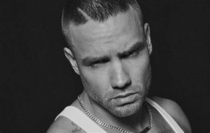 Unraveling the Mystery Behind Liam Payne's Hair Loss