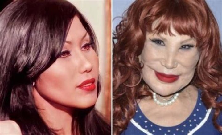 Lyn May: A Journey of Transformation - Before and After