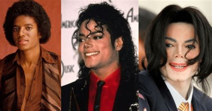 Michael Jackson with Vitiligo: The Iconic Journey of a Global Legend