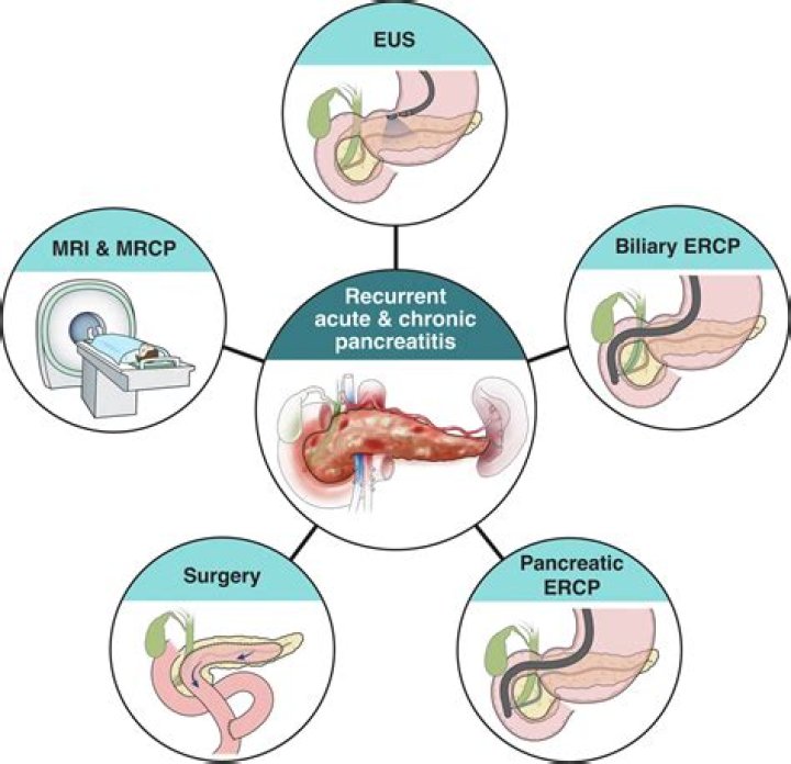 Patrick Wayze Pancreatic Cancer Symptoms: A Comprehensive Guide