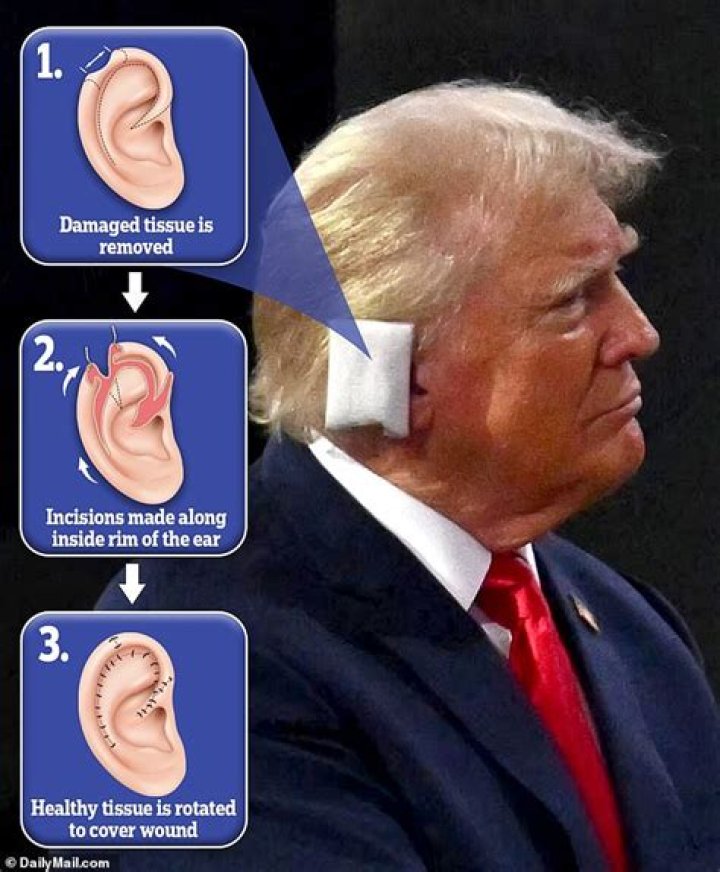 Understanding the Fascination with Pictures of Trump's Ear