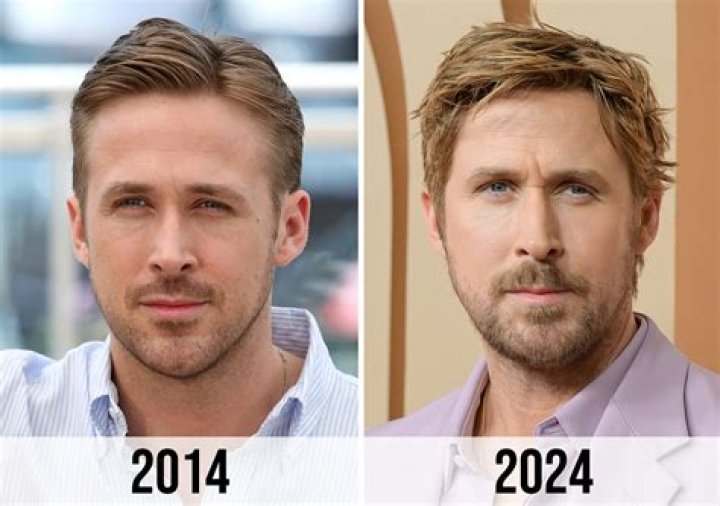 Unveiling the Truth Behind Ryan Gosling's Botox Rumors