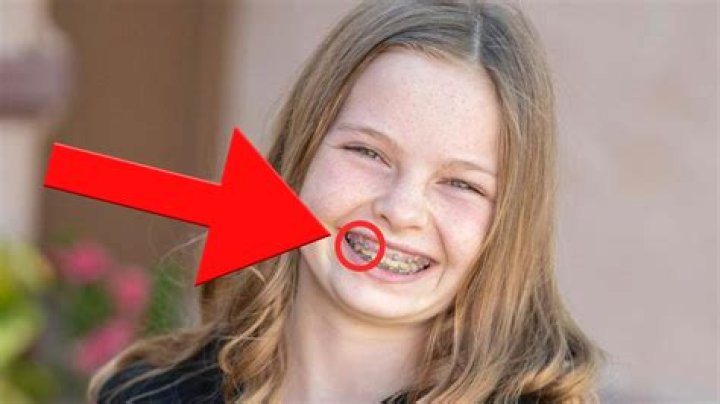 Understanding Salish Matter Lisp: The Language of the Salishan Indigenous Peoples