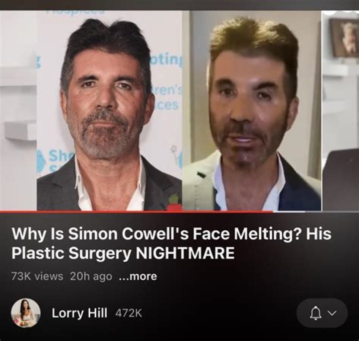 Simon Cowell: The Remarkable Journey of a Music Mogul Battling Disability