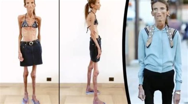 The Ultimate Guide to the World's Skinniest Human