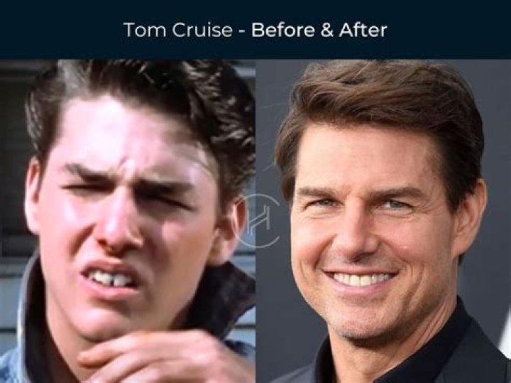 Tom Cruise's Wives: A Comprehensive Look at His Marriages