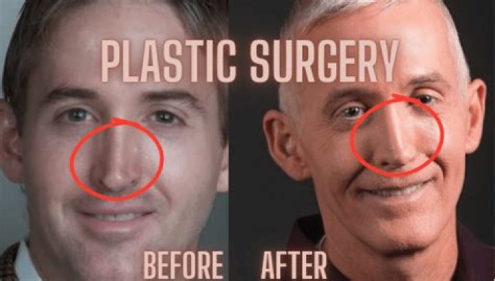 Trey Gowdy's Transformation: Unveiling the Truth Behind His Plastic Surgery Rumors