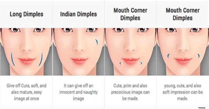 Discovering the Delightful Types of Dimples
