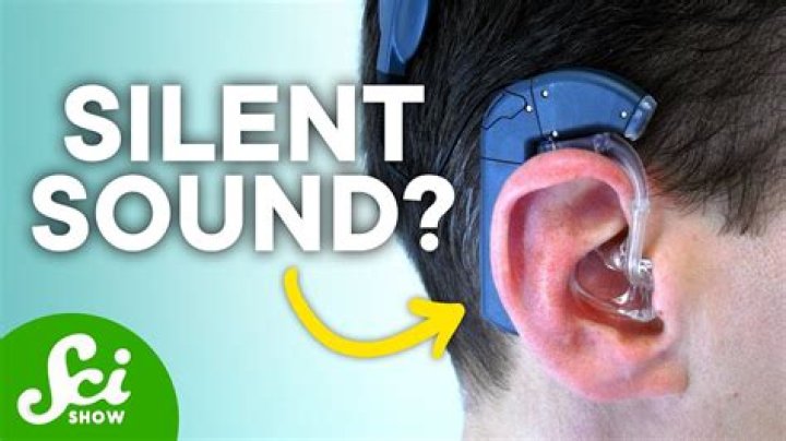 What Does a Cochlear Implant Sound Like? Understanding the Experience