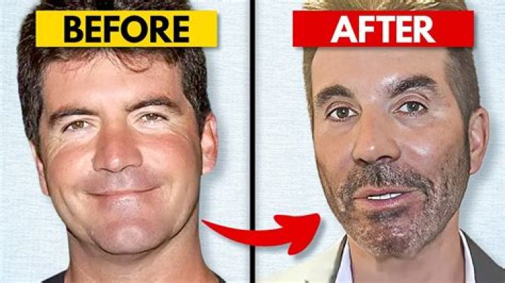What Happened to Simon Cowell: The Untold Story Behind His Transformation