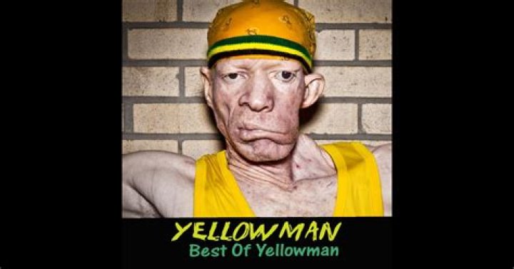 What Happened to King Yellowman? The Rise, Struggles, and Legacy of a Reggae Icon