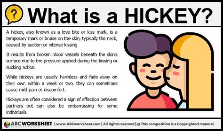 What is a Hickey? A Comprehensive Guide to Understanding, Prevention, and Treatment