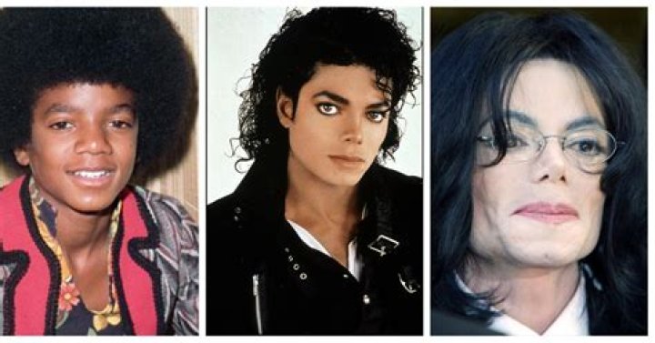 What Was Michael Jackson's Skin Disease? Unveiling the Truth Behind the King of Pop's Health